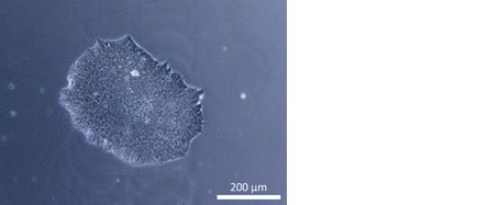 Fig. 6. Example of patient-derived iPS cells