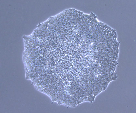 iPS cell shape