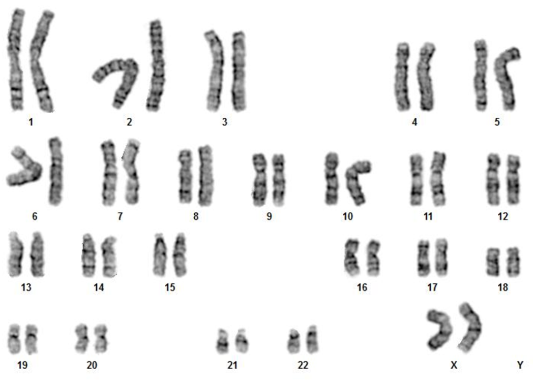 Chromosome analysis
