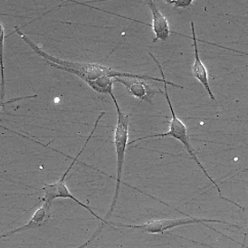Phase-contrast image of hiPSCs-derived Schwann cells