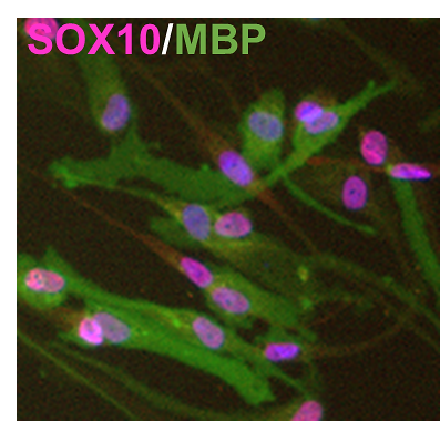 Immunofluorescence image of SOX10 and MBP